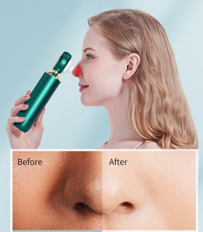 Electric Blackhead Remover – Pore Vacuum Cleaner